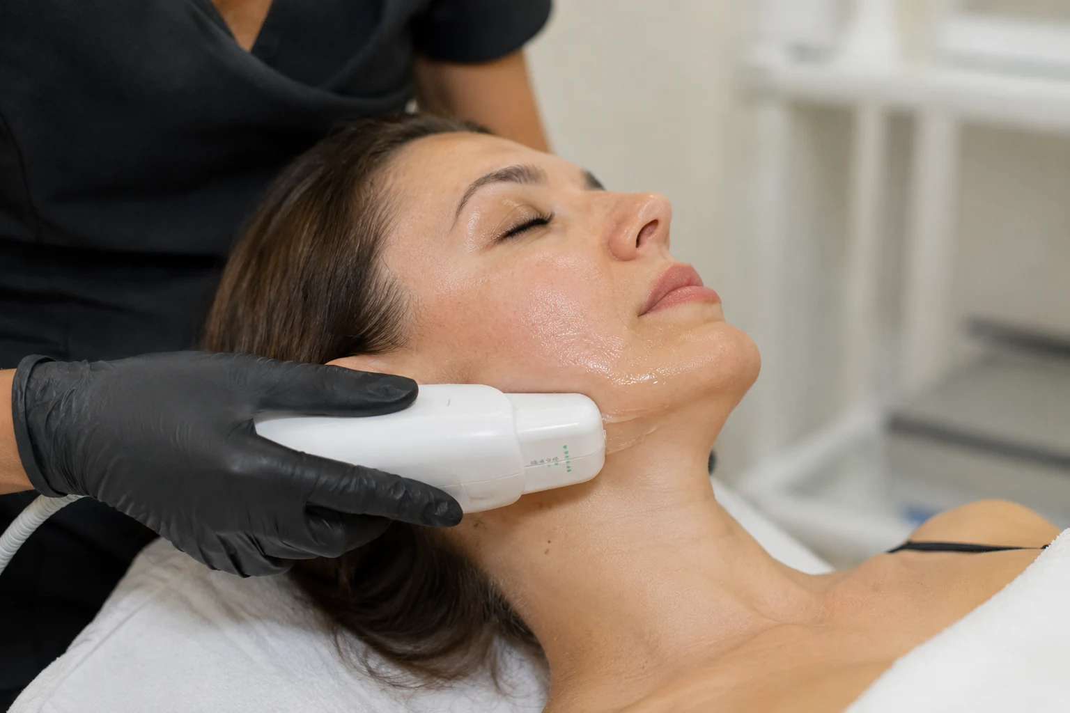 Aplicación de HIFU facial en Vivaltia