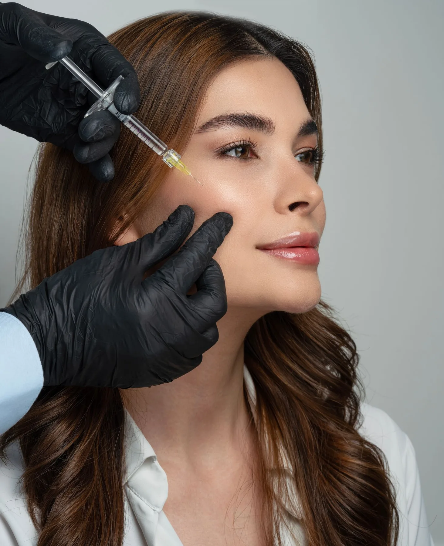 Aplicación clínica de un relleno facial en la zona del pómulo