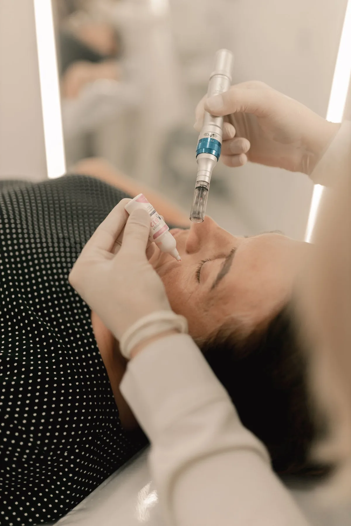 Tratamiento facial de microneedling con un dispositivo de micropunciones